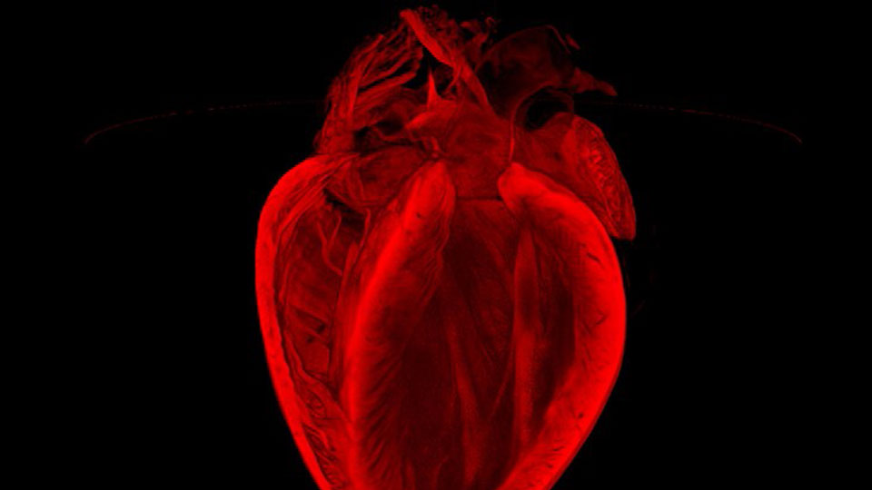 'Tis Pity She's A Whore